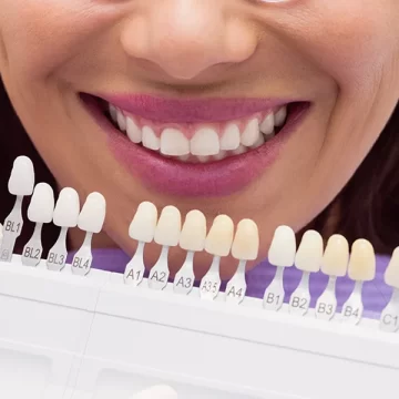 How Long Do Veneers Last and How to Make Them Last Longer