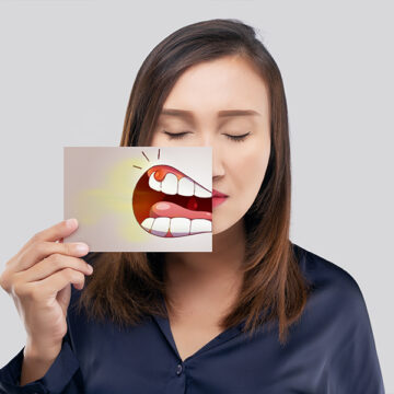 White Gums Around Teeth: How Laser Gum Therapy Can Help