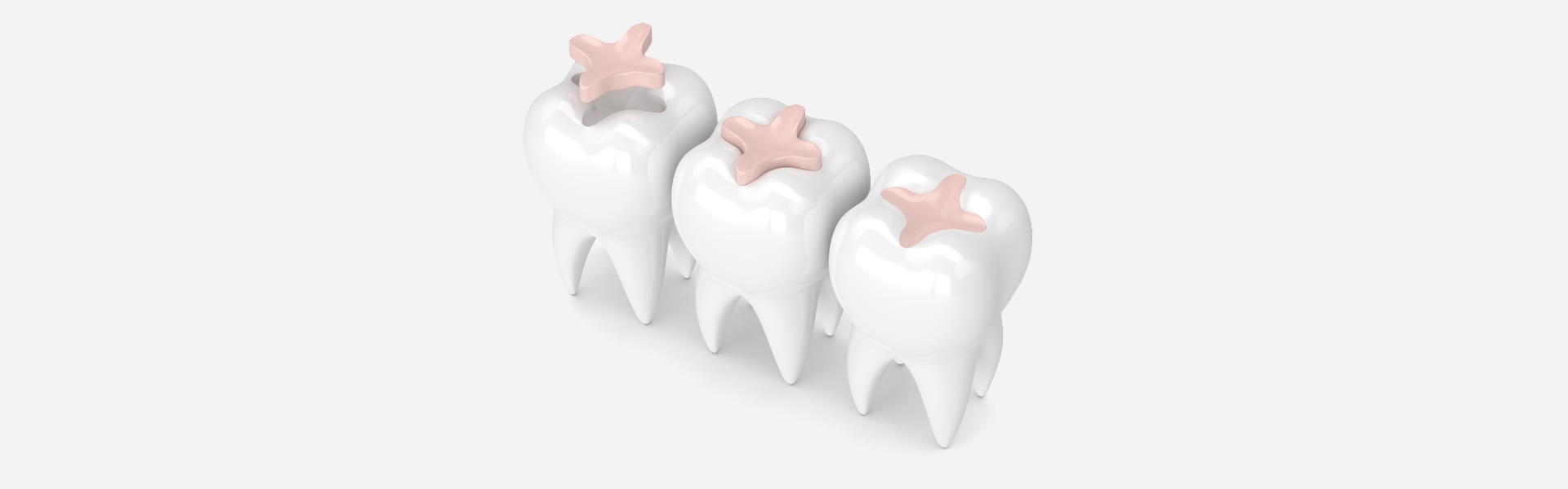 How Long Do Dental Fillings Last? Tips for Maintenance