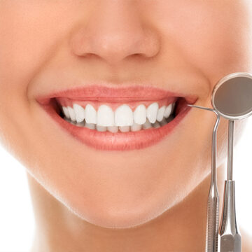 How Do You Take Care of Your Teeth After Whitening?