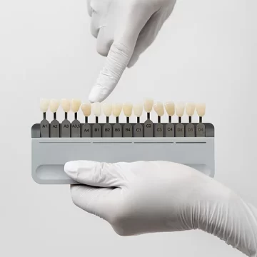 How to Care for Your Veneers and Keep Them Looking New